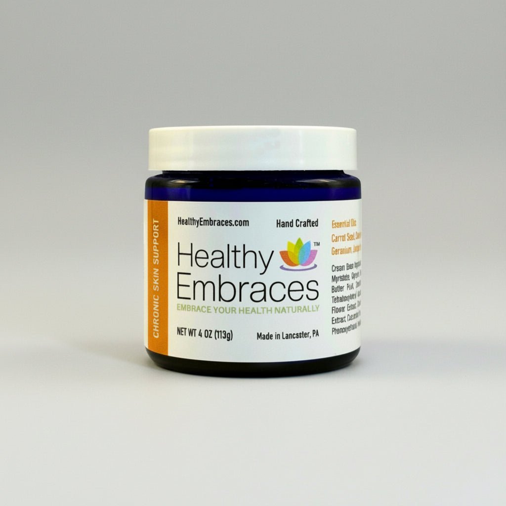 Chronic Skin Support Cream - centralpennreflexology.com